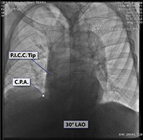 CXR Sweet Spot™ Box Measurements